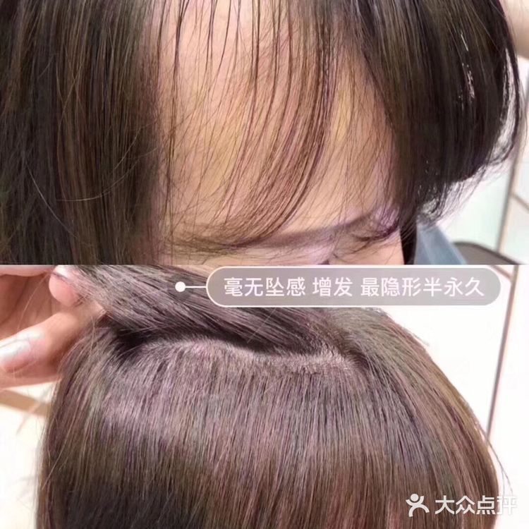 物理接发 增量 减龄
