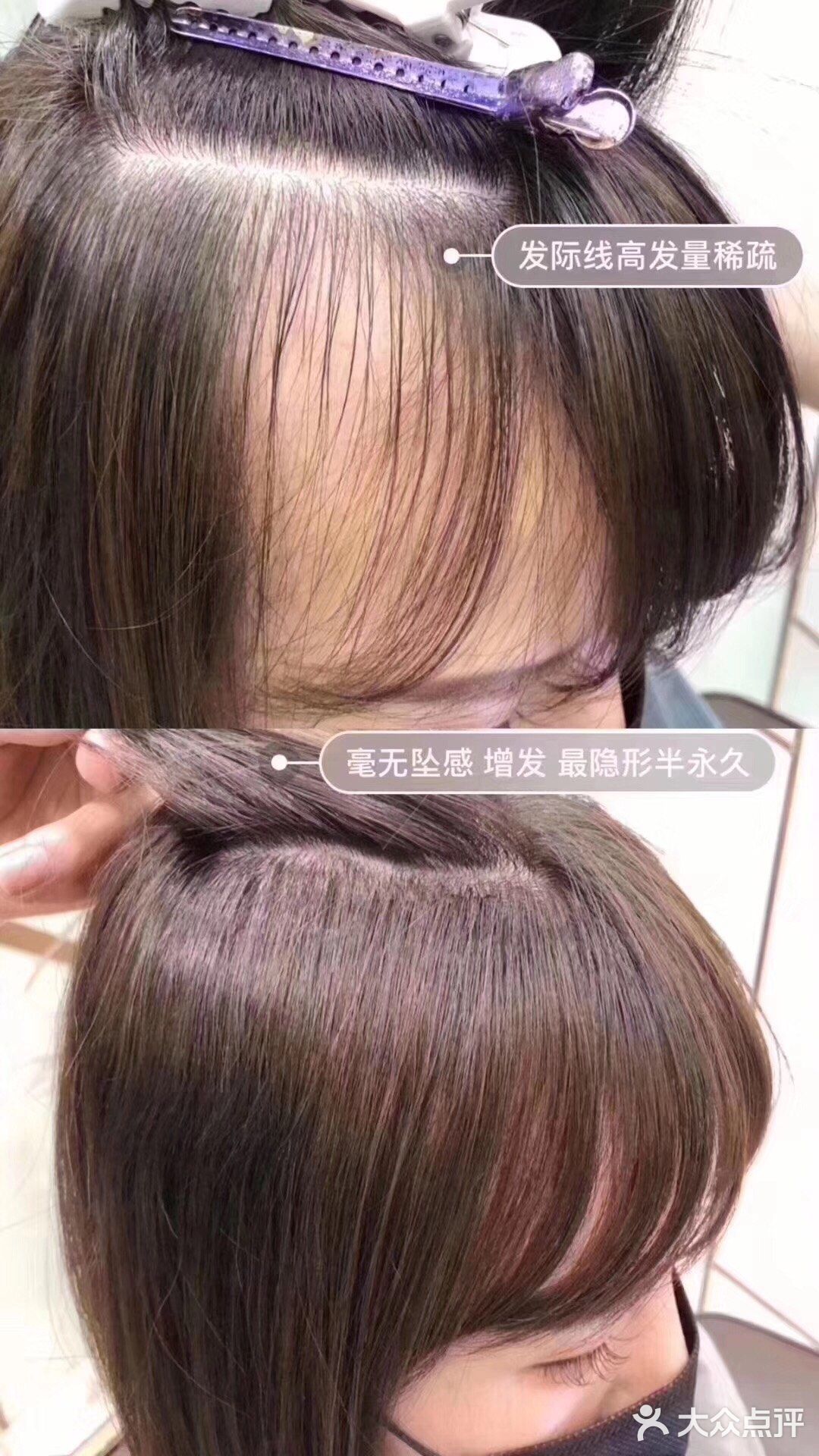 物理接发 增量 减龄