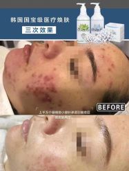 -苗方清颜痘肌研究所