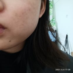 体验后-厦门美莱整形美容医院