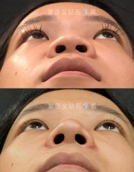 -北京米扬丽格医疗美容·联合丽格鼻整形中心
