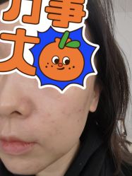 体验后-来美轻医美抗衰中心