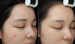 -SKINIST丽铂医疗美容