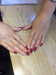 -薇兰专业脱毛连锁机构