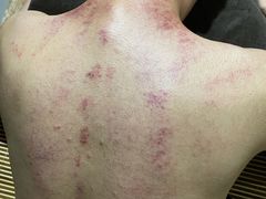 -中艾堂都市灸养会所(延庆店)