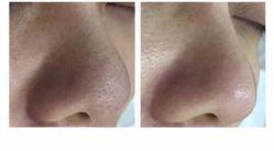 点击看大图 -Face Score美甲美睫皮肤管理