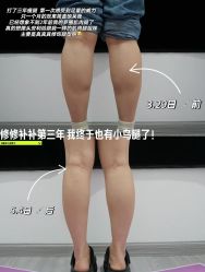 -上海伊莱美医疗美容医院