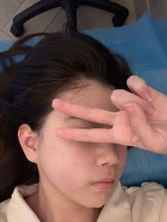 体验后-深圳鹏爱秀琪医疗美容医院