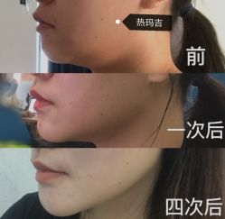 -上海漾颜医疗美容