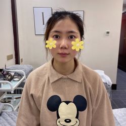 -I纹眉·半永久