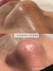 点击看大图 -E.beauty驻颜·痘敏肌调理中心