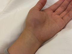 -长白山万达国际滑雪场