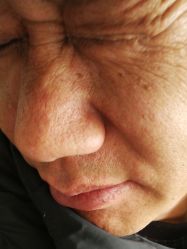 -痣清宫祛斑祛痣连锁店