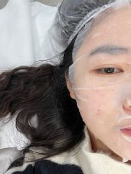 体验后-上海首尔丽格医疗美容医院