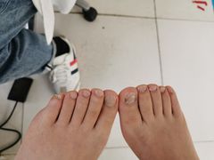 -新甲连锁灰指甲·甲沟炎·鸡眼(黑龙江路店)