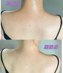 -LUNA皮相美·骨相美高级美感