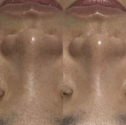 -美愈美肤MEIYU SKIN