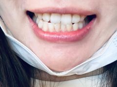 -土豆口腔(凤凰北总店)