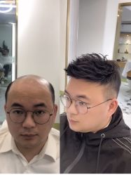 -发饰美男士增发补发假发定制店
