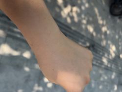 -咪咪比基尼脱毛专业店