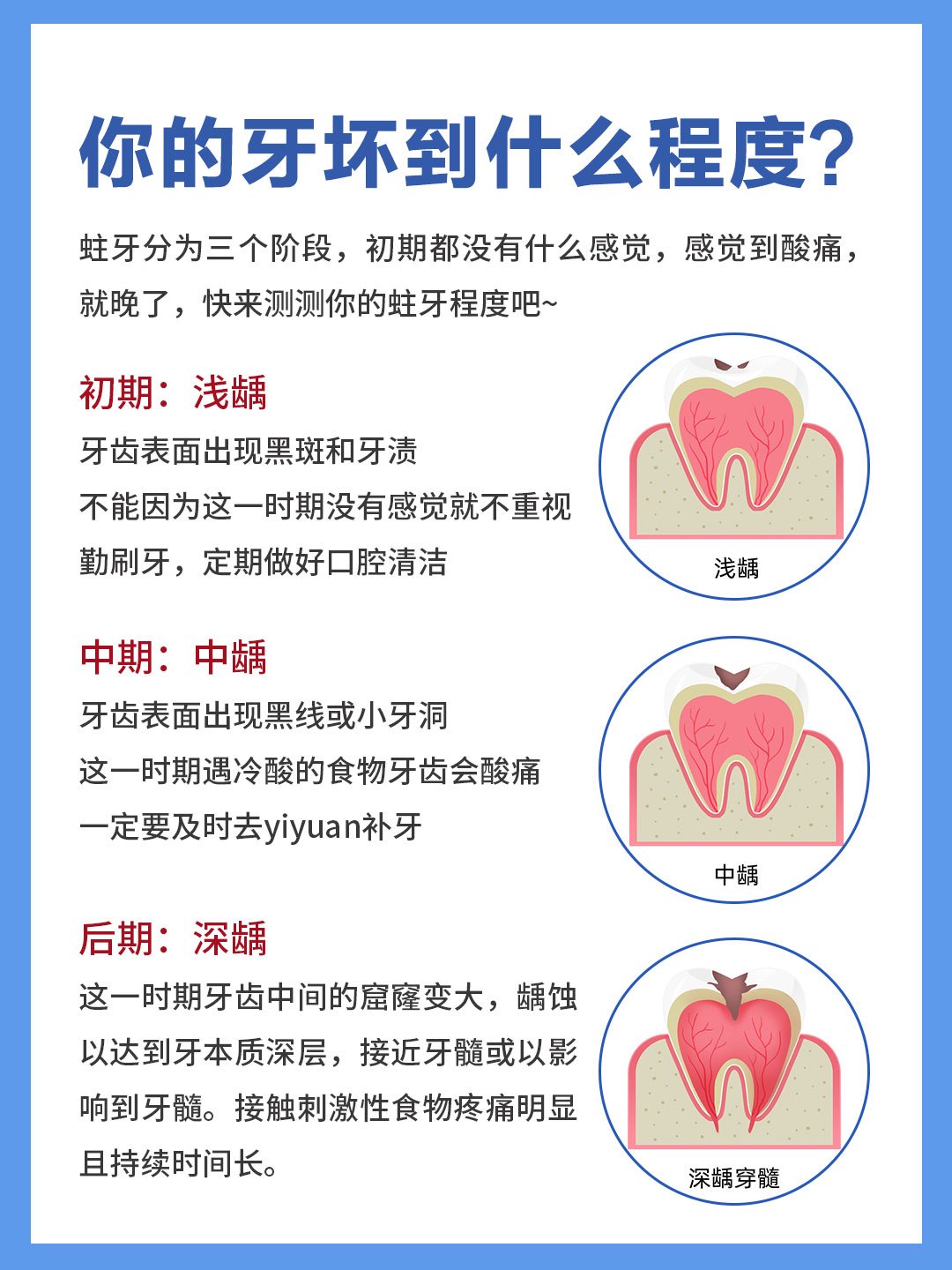 深龋去净腐质的标准图图片