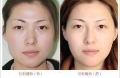 -CMS西美斯·美式医疗美容