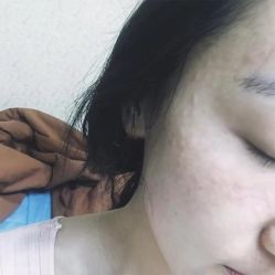 -一美医疗美容