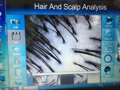 检测头皮-意廊 Hair Salon