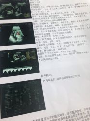 -杭州贝瑞斯美华妇儿医院·早孕·产检·儿科