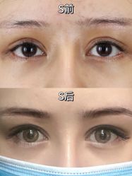 -丰联丽格医疗美容·联合丽格眼整形中心