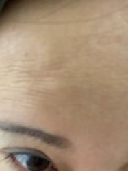 体验后-深圳美莱医疗美容医院