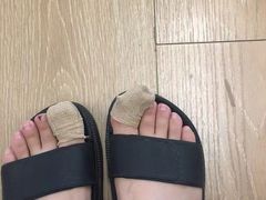 -世龙世家灰指甲·甲沟炎·跖疣护理·修脚(东江湾路店)