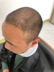 -发饰美男士增发补发假发定制店