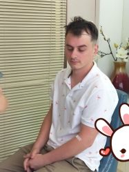 -大麦微针植发丨全国连锁