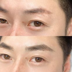 -德绣·机器野生眉发际线·美瞳线半永久