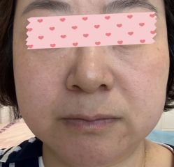 -Yestar 嘉兴艺星医疗美容医院