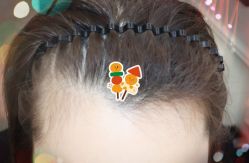 -大麦微针植发全国连锁