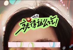 -大麦微针植发全国连锁