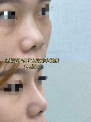 -深圳艺星医疗美容医院