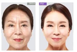 -北京米扬丽格医疗美容·联合丽格鼻整形中心