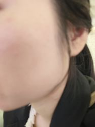 -长沙雅美医疗美容医院