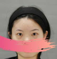 -天津健丽·去眼袋医疗美容机构