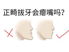 -深圳佑诺口腔门诊部