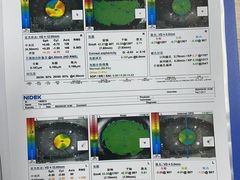 -苏州大学理想眼科医院