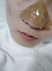 -蕾特恩专业祛痘国际连锁