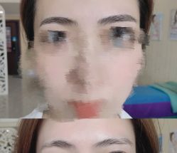 点击看大图 -西施无菌半永久纹绣眉眼影唇轻增发纹发际线