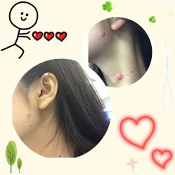 -成都军建医院·疤痕诊疗中心