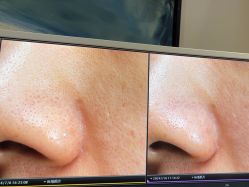 -苑苑vbeauty科技美容SPA