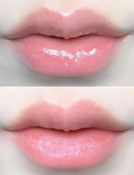 点击看大图 -SKINIST丽铂医疗美容