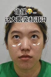 -广州健丽·去眼袋医疗美容机构